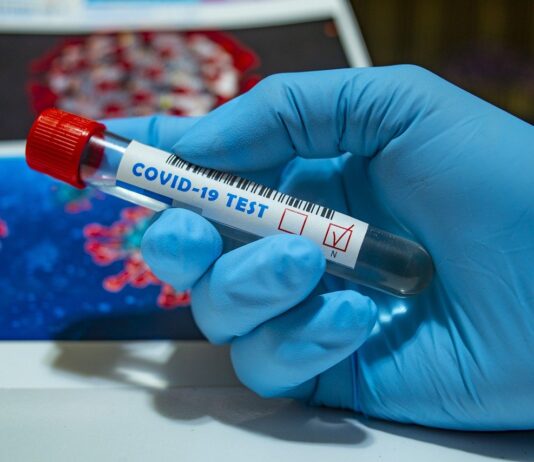 Coronavirus: in Toscana 41 nuovi casi, 1 decesso, 13 guarigioni