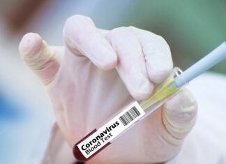 Coronavirus, 103 nuovi casi nell’aretino