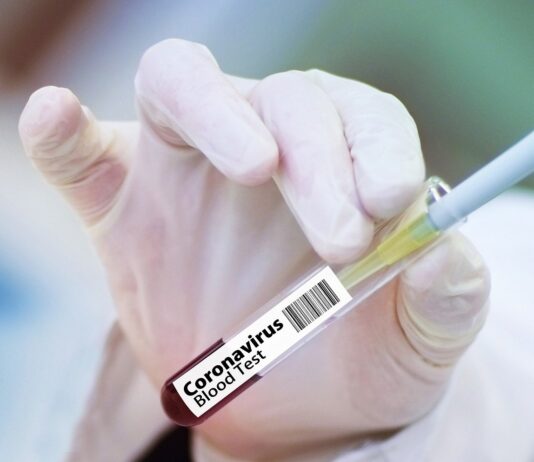 Coronavirus, 44 nuovi casi nell’aretino