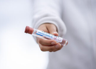 Coronavirus in Toscana: 11.622 i guariti totali, 906 nuovi casi, 440 ricoverati, 5 decessi