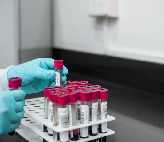 Coronavirus: in Toscana 1.196 nuovi casi, età media 49 anni. 47 decessi