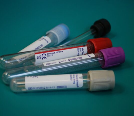 Coronavirus: 97 nuovi casi nell’aretino, 110 in degenza covid, 29 in terapia intensiva, 16 persone guarite, 2 decessi