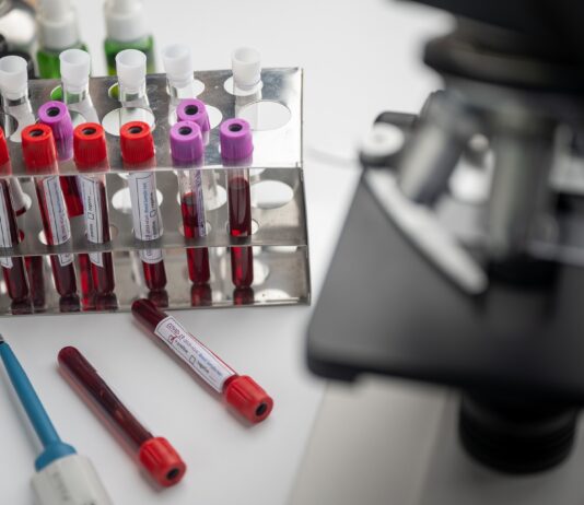 Coronavirus, 43 nuovi casi nell’aretino, 10 persone in degenza covid, 2 in terapia intensiva