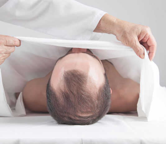 Dalla Germania uno studio sui pazienti deceduti a causa del vaccino Covid-19