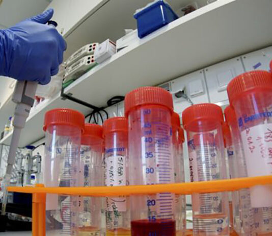 Coronavirus: 37 nuovi casi nell’aretino, 5 persone in degenza covid, 2 in terapia intensiva