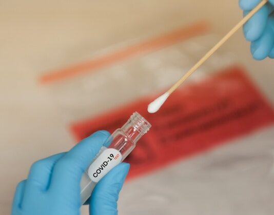 Coronavirus: in Toscana 955 nuovi casi positivi. Sei decessi con un’età media di 81,7 anni