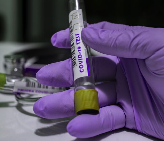 Coronavirus: in Toscana 10.287 nuovi casi. 32 decessi con un’età media di 81,9 anni