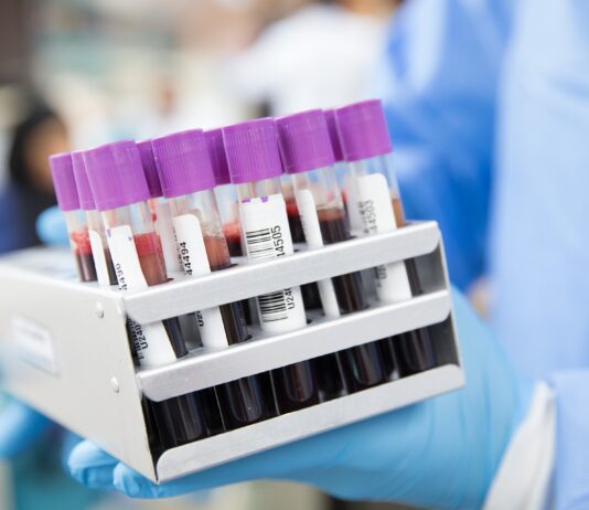 Coronavirus Toscana, 1664 nuovi casi