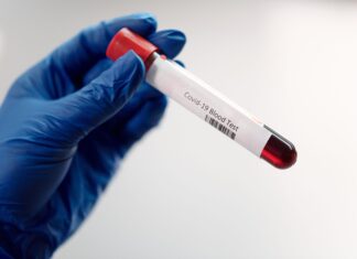 Coronavirus: In Toscana 2.166 nuovi casi. 9 decessi